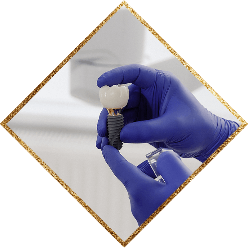 dental implant in hand