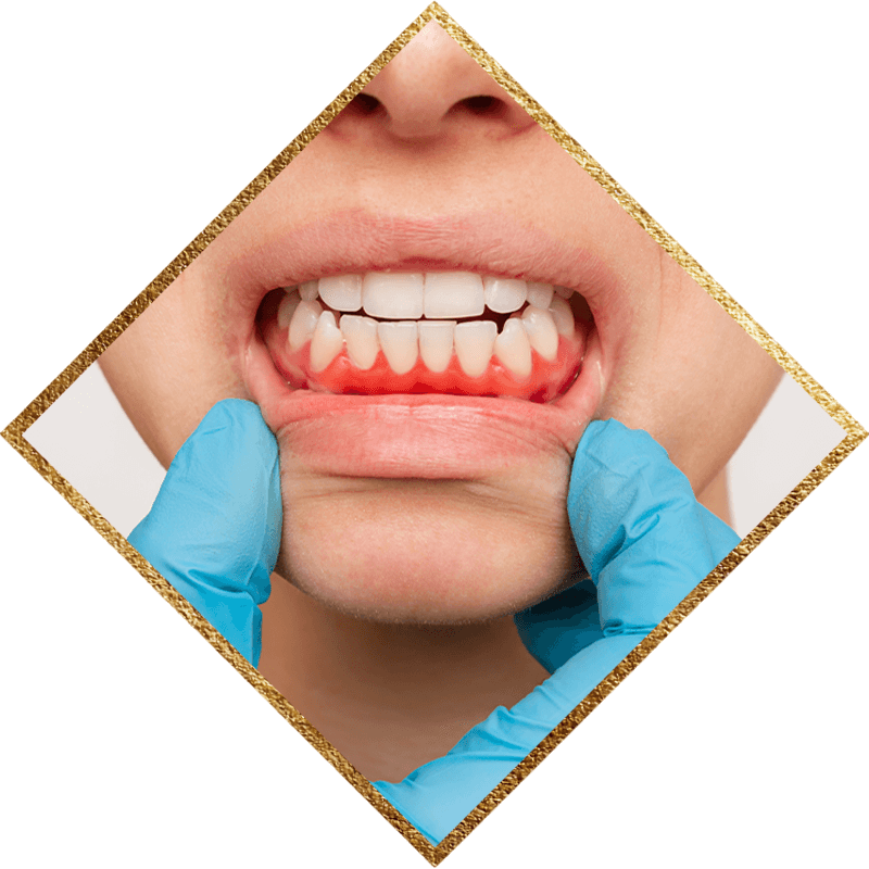 gum disease being looked at